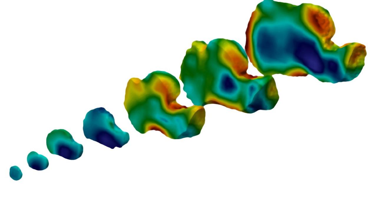 A developmental series of human heel bones showing changes in the internal trabecular bone structure