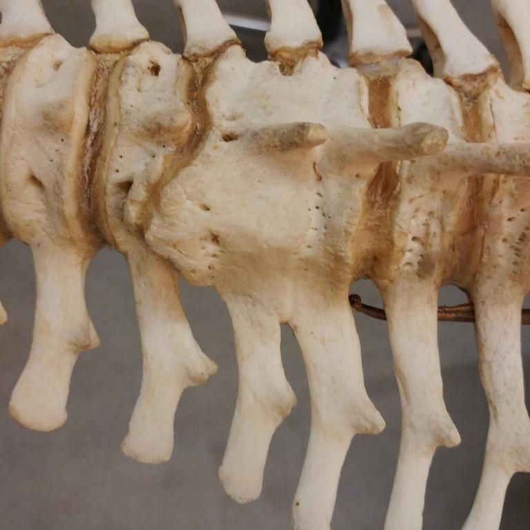 gefuseerde ruggenwervels